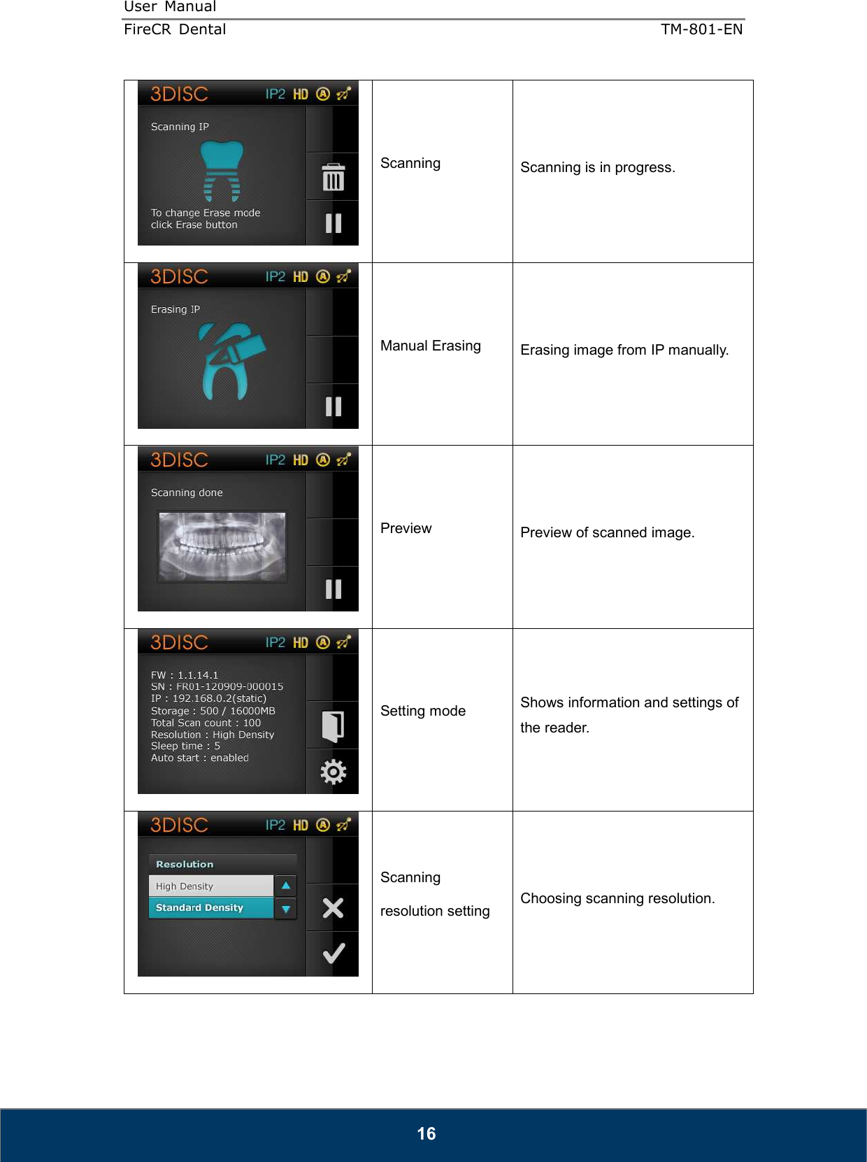 User  Manual  FireCR  Dental    TM-801-EN   16  Scanning  Scanning is in progress.  Manual Erasing  Erasing image from IP manually.  Preview  Preview of scanned image.  Setting mode  Shows information and settings of the reader.    Scanning resolution setting  Choosing scanning resolution. 