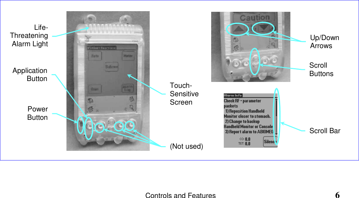                   Controls and Features                                                     6Life-ThreateningAlarm LightApplicationButtonUp/DownArrowsScrollButtonsScroll BarTouch-SensitiveScreen(Not used)PowerButton