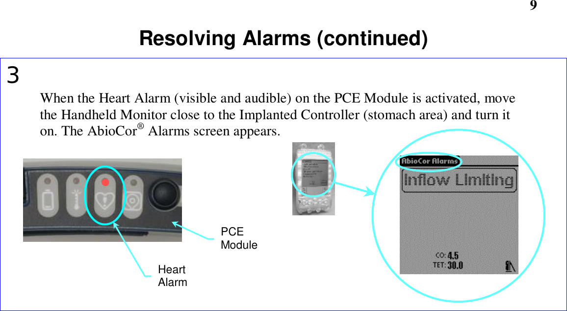                     9Resolving Alarms (continued)3When the Heart Alarm (visible and audible) on the PCE Module is activated, movethe Handheld Monitor close to the Implanted Controller (stomach area) and turn iton. The AbioCor® Alarms screen appears.HeartAlarmPCEModule