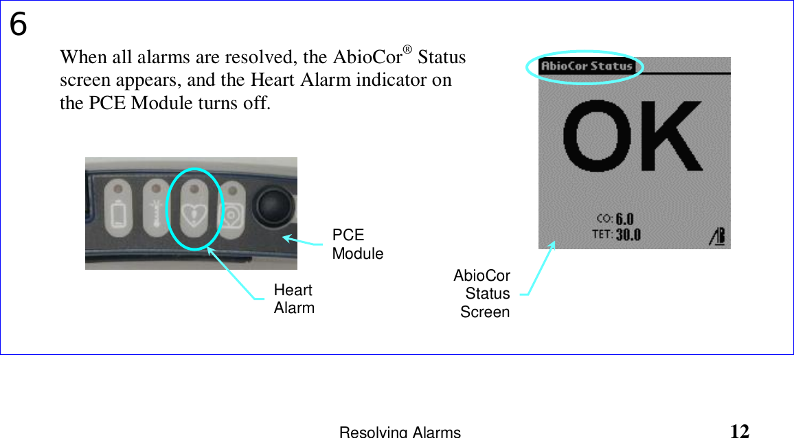                       Resolving Alarms                                                       126When all alarms are resolved, the AbioCor® Statusscreen appears, and the Heart Alarm indicator onthe PCE Module turns off.AbioCorStatusScreenHeartAlarmPCEModule