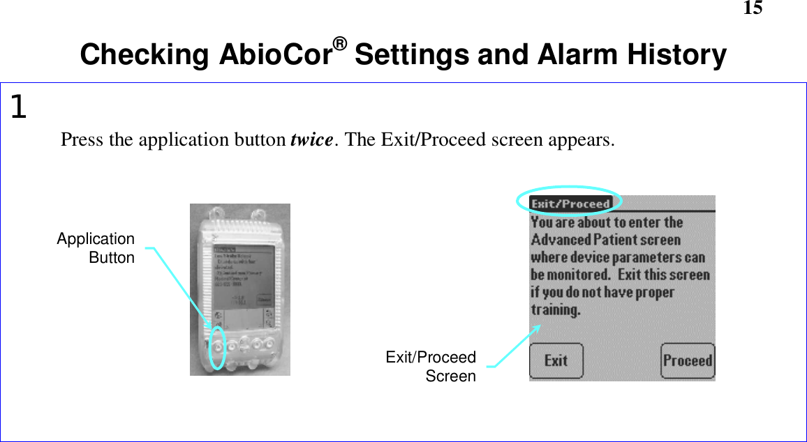       15Checking AbioCor® Settings and Alarm History1Press the application button twice. The Exit/Proceed screen appears.ApplicationButtonExit/ProceedScreen