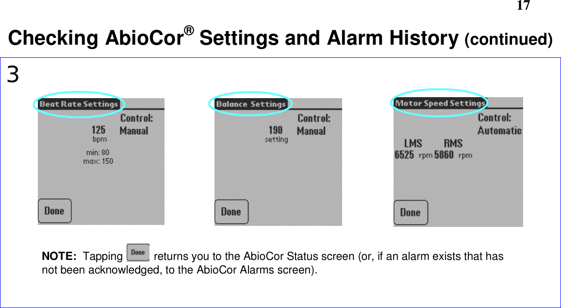       17Checking AbioCor® Settings and Alarm History (continued)3NOTE:  Tapping          returns you to the AbioCor Status screen (or, if an alarm exists that hasnot been acknowledged, to the AbioCor Alarms screen).