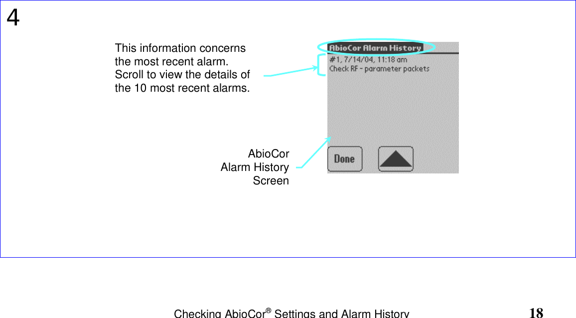                                                                       Checking AbioCor® Settings and Alarm History                                 184This information concernsthe most recent alarm.Scroll to view the details ofthe 10 most recent alarms.AbioCorAlarm HistoryScreen