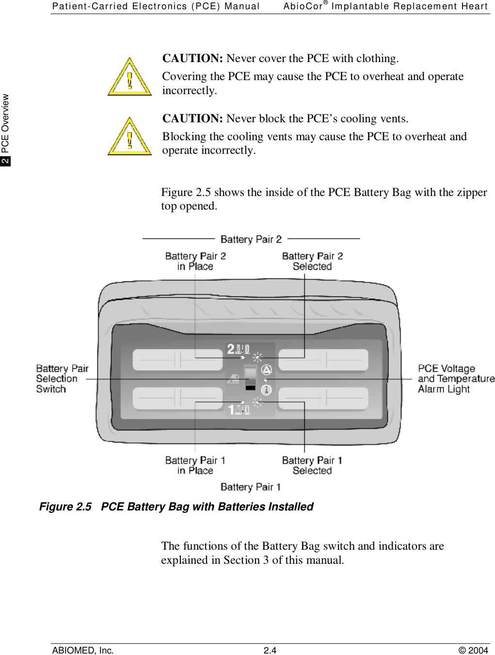 Patient-Carried Electronics (PCE) Manual AbioCor® Implantable Replacement HeartABIOMED, Inc. 2.4 © 2004 2  PCE OverviewCAUTION: Never cover the PCE with clothing.Covering the PCE may cause the PCE to overheat and operateincorrectly.CAUTION: Never block the PCE’s cooling vents.Blocking the cooling vents may cause the PCE to overheat andoperate incorrectly.Figure 2.5 shows the inside of the PCE Battery Bag with the zippertop opened.Figure 2.5   PCE Battery Bag with Batteries InstalledThe functions of the Battery Bag switch and indicators areexplained in Section 3 of this manual.