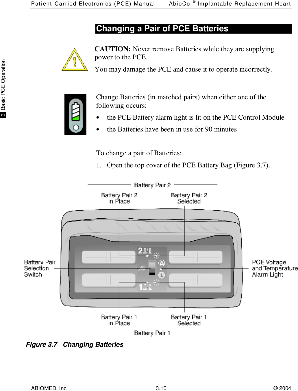 Patient-Carried Electronics (PCE) Manual AbioCor® Implantable Replacement HeartABIOMED, Inc. 3.10 © 2004 3  Basic PCE OperationChanging a Pair of PCE BatteriesCAUTION: Never remove Batteries while they are supplyingpower to the PCE.You may damage the PCE and cause it to operate incorrectly.Change Batteries (in matched pairs) when either one of thefollowing occurs:• the PCE Battery alarm light is lit on the PCE Control Module• the Batteries have been in use for 90 minutesTo change a pair of Batteries:1. Open the top cover of the PCE Battery Bag (Figure 3.7).Figure 3.7   Changing Batteries