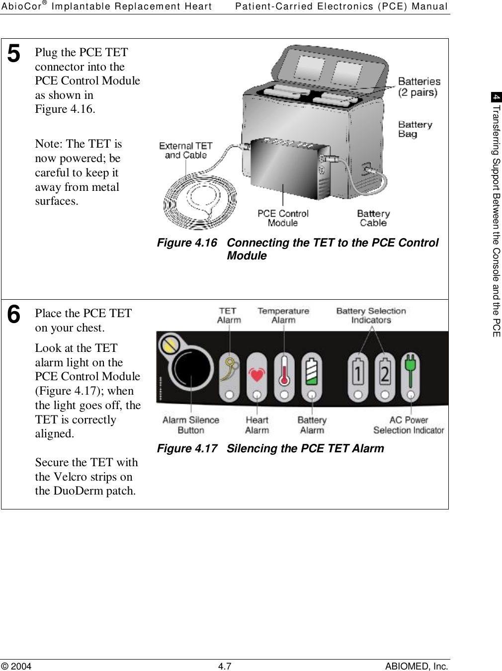 AbioCor® Implantable Replacement Heart Patient-Carried Electronics (PCE) Manual© 2004 4.7 ABIOMED, Inc. 4  Transferring Support Between the Console and the PCE5Plug the PCE TETconnector into thePCE Control Moduleas shown inFigure 4.16.Note: The TET isnow powered; becareful to keep itaway from metalsurfaces.Figure 4.16   Connecting the TET to the PCE ControlModule6Place the PCE TETon your chest.Look at the TETalarm light on thePCE Control Module(Figure 4.17); whenthe light goes off, theTET is correctlyaligned.Secure the TET withthe Velcro strips onthe DuoDerm patch.Figure 4.17   Silencing the PCE TET Alarm