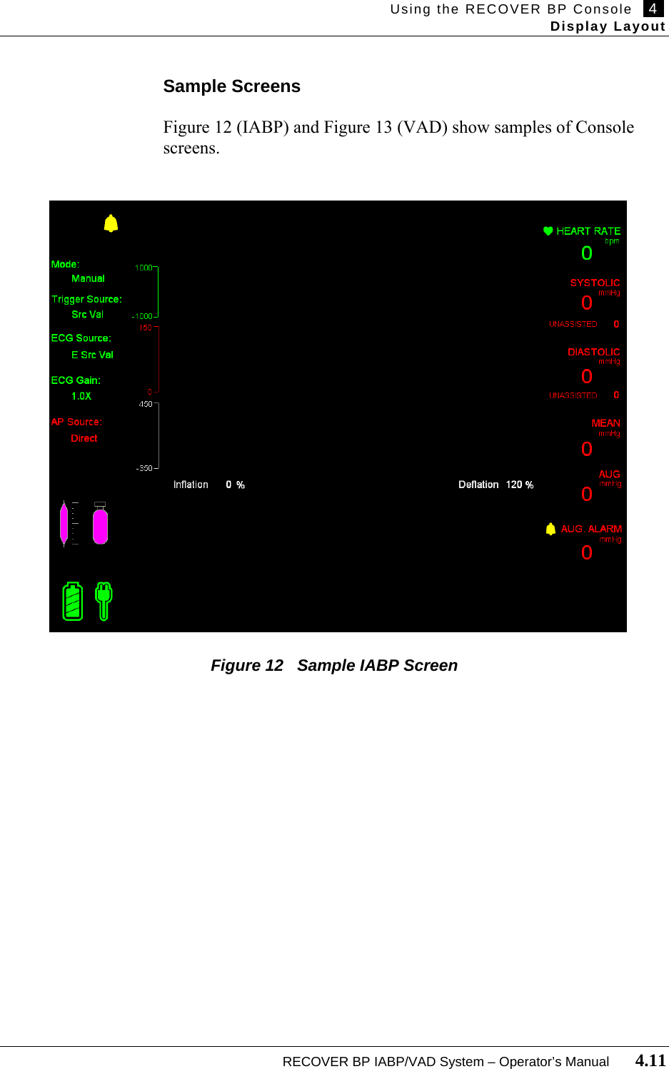 Using the RECOVER BP Console   4   Display Layout  RECOVER BP IABP/VAD System – Operator’s Manual       4.11  Sample Screens  Figure 12 (IABP) and Figure 13 (VAD) show samples of Console screens.                                       Figure 12   Sample IABP Screen 