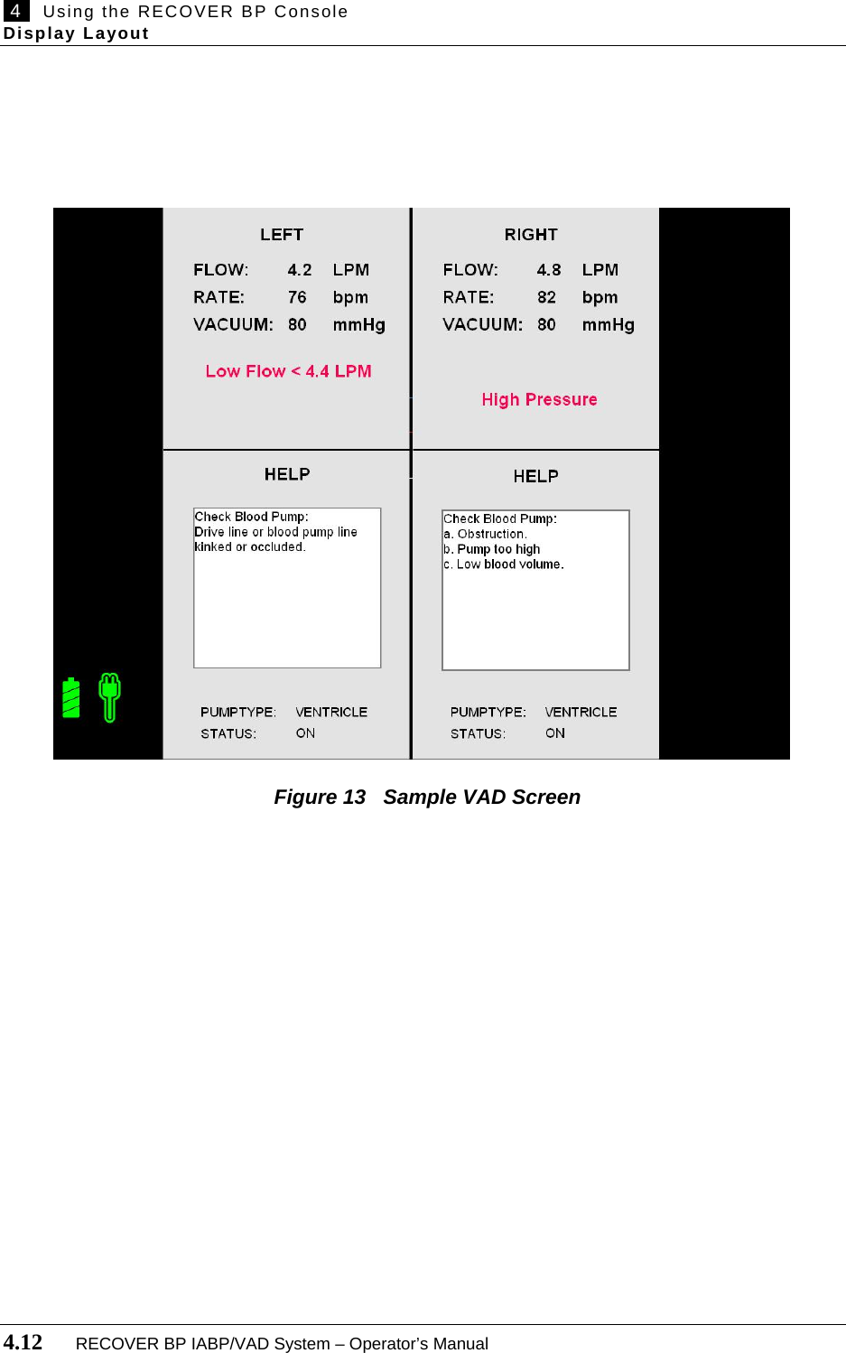  4   Using the RECOVER BP Console Display Layout  4.12       RECOVER BP IABP/VAD System – Operator’s Manual                Figure 13   Sample VAD Screen     
