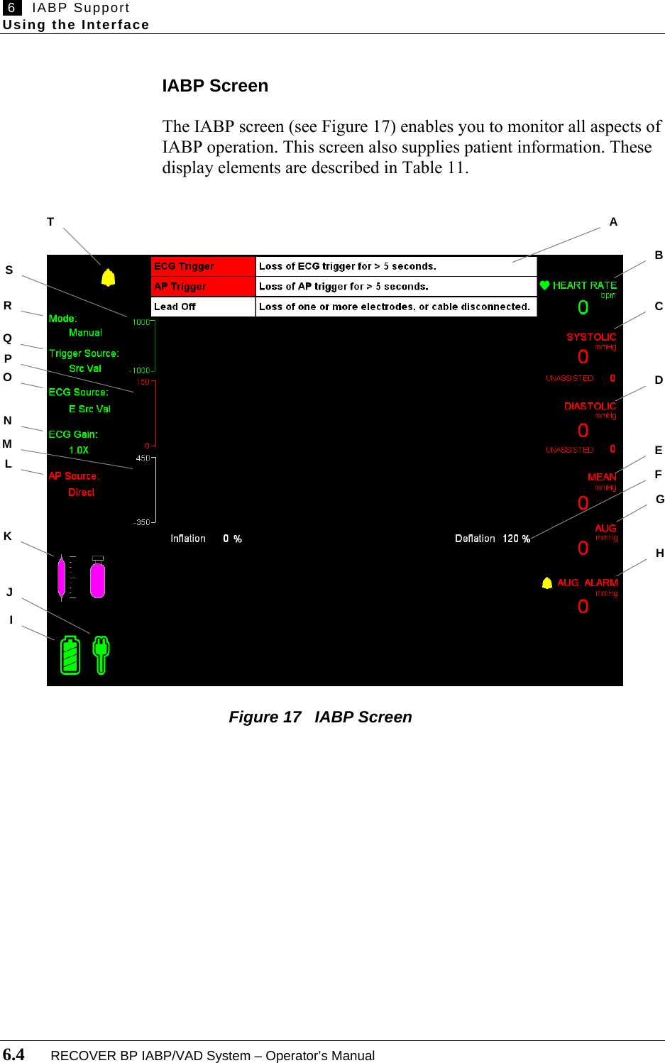  6   IABP Support Using the Interface  6.4       RECOVER BP IABP/VAD System – Operator’s Manual  IABP Screen  The IABP screen (see Figure 17) enables you to monitor all aspects of IABP operation. This screen also supplies patient information. These display elements are described in Table 11.                                      Figure 17   IABP Screen   IB RJA C D E G H TSF QONPMLK
