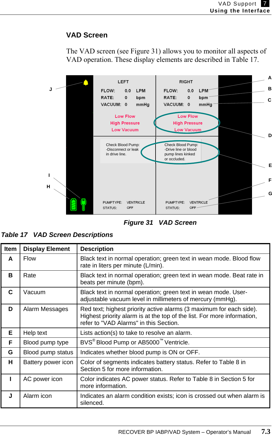 VAD Support   7   Using the Interface  RECOVER BP IABP/VAD System – Operator’s Manual       7.3  VAD Screen  The VAD screen (see Figure 31) allows you to monitor all aspects of VAD operation. These display elements are described in Table 17.                           Figure 31   VAD Screen  Table 17   VAD Screen Descriptions  Item Display Element  Description A  Flow  Black text in normal operation; green text in wean mode. Blood flow rate in liters per minute (L/min). B  Rate  Black text in normal operation; green text in wean mode. Beat rate in beats per minute (bpm). C  Vacuum  Black text in normal operation; green text in wean mode. User-adjustable vacuum level in millimeters of mercury (mmHg). D  Alarm Messages  Red text; highest priority active alarms (3 maximum for each side). Highest priority alarm is at the top of the list. For more information, refer to &quot;VAD Alarms&quot; in this Section. E  Help text  Lists action(s) to take to resolve an alarm. F  Blood pump type  BVS® Blood Pump or AB5000™ Ventricle. G  Blood pump status  Indicates whether blood pump is ON or OFF. H  Battery power icon  Color of segments indicates battery status. Refer to Table 8 in Section 5 for more information. I  AC power icon  Color indicates AC power status. Refer to Table 8 in Section 5 for more information. J  Alarm icon  Indicates an alarm condition exists; icon is crossed out when alarm is silenced.   Check Blood Pump:-Disconnect or leakin drive line.Check Blood Pump:-Drive line or bloodpump lines kinkedor occluded. HA D E I  F G B C  J 
