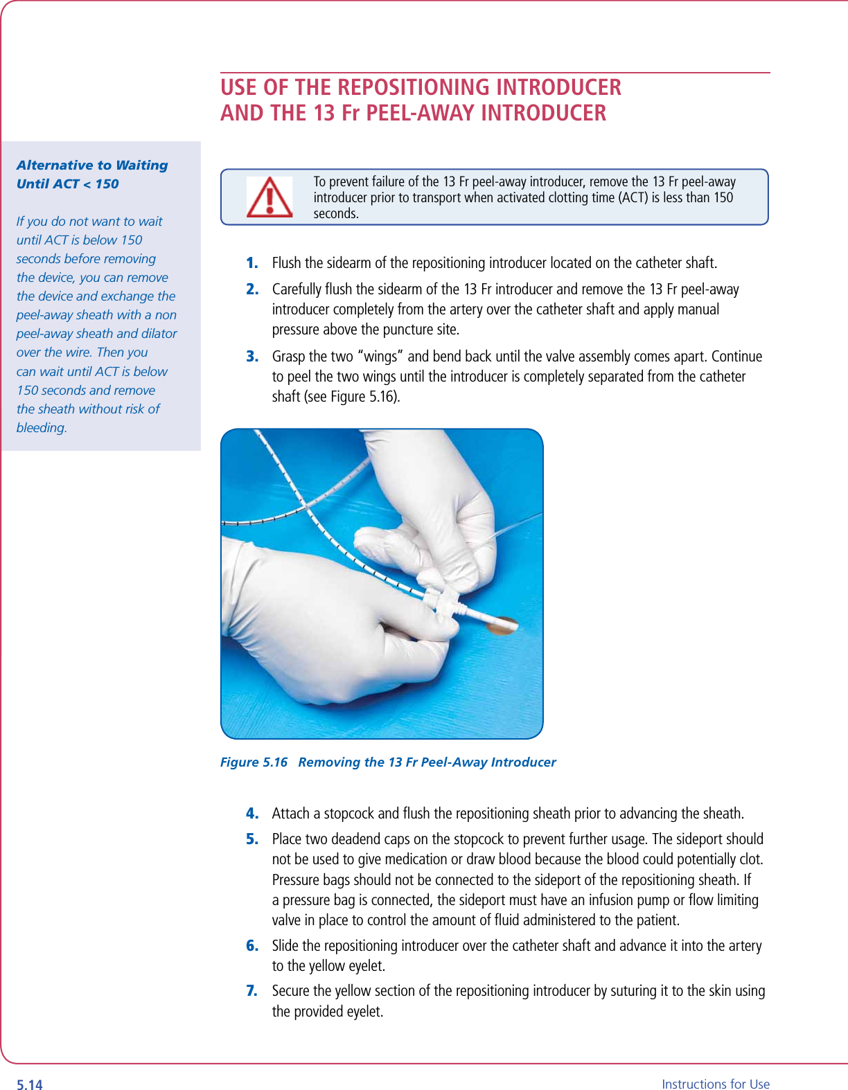 5.14 Instructions for UseUSE OF THE REPOSITIONING INTRODUCER AND THE 13 Fr PEEL-AWAY INTRODUCERTo prevent failure of the 13 Fr peel-away introducer, remove the 13 Fr peel-away introducer prior to transport when activated clotting time (ACT) is less than 150 seconds.1.   Flush the sidearm of the repositioning introducer located on the catheter shaft.2.   Carefully ﬂush the sidearm of the 13 Fr introducer and remove the 13 Fr peel-away introducer completely from the artery over the catheter shaft and apply manual pressure above the puncture site.3.   Grasp the two “wings” and bend back until the valve assembly comes apart. Continue to peel the two wings until the introducer is completely separated from the catheter shaft (see Figure 5.16).Figure 5.16   Removing the 13 Fr Peel-Away Introducer4.   Attach a stopcock and ﬂush the repositioning sheath prior to advancing the sheath.5.   Place two deadend caps on the stopcock to prevent further usage. The sideport should not be used to give medication or draw blood because the blood could potentially clot. Pressure bags should not be connected to the sideport of the repositioning sheath. If a pressure bag is connected, the sideport must have an infusion pump or ﬂow limiting valve in place to control the amount of ﬂuid administered to the patient.6.   Slide the repositioning introducer over the catheter shaft and advance it into the artery to the yellow eyelet.7.   Secure the yellow section of the repositioning introducer by suturing it to the skin using the provided eyelet.Alternative to Waiting Until ACT &lt; 150If you do not want to wait until ACT is below 150 seconds before removing the device, you can remove the device and exchange the peel-away sheath with a non peel-away sheath and dilator over the wire. Then you can wait until ACT is below 150 seconds and remove the sheath without risk of bleeding.