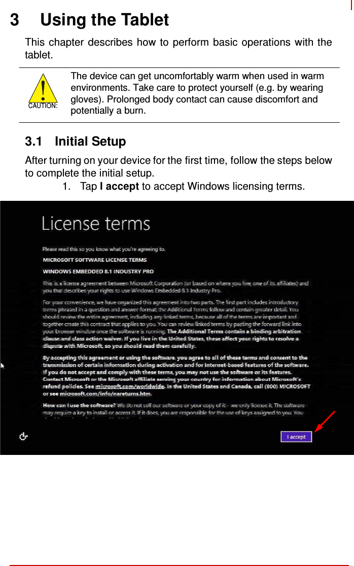    3 Using the Tablet  This chapter describes how to perform basic operations with the tablet.     CAUTION:  The device can get uncomfortably warm when used in warm environments. Take care to protect yourself (e.g. by wearing gloves). Prolonged body contact can cause discomfort and potentially a burn.   3.1  Initial Setup  After turning on your device for the first time, follow the steps below to complete the initial setup. 1.  Tap I accept to accept Windows licensing terms. 