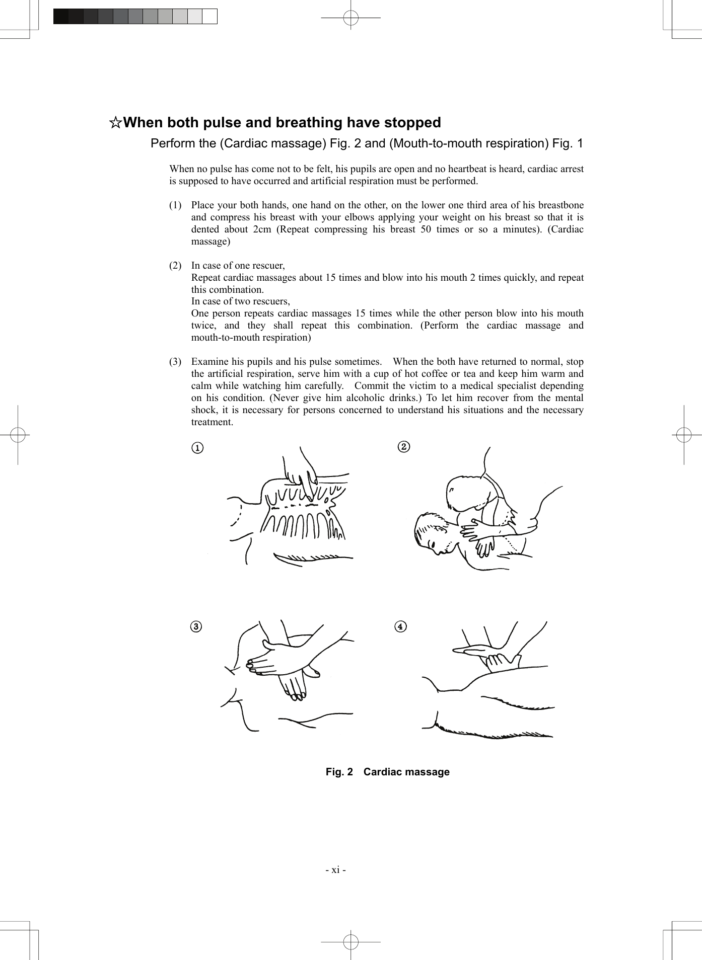  - xi - ☆When both pulse and breathing have stopped Perform the (Cardiac massage) Fig. 2 and (Mouth-to-mouth respiration) Fig. 1  When no pulse has come not to be felt, his pupils are open and no heartbeat is heard, cardiac arrest is supposed to have occurred and artificial respiration must be performed.  (1)  Place your both hands, one hand on the other, on the lower one third area of his breastbone and compress his breast with your elbows applying your weight on his breast so that it is dented about 2cm (Repeat compressing his breast 50 times or so a minutes). (Cardiac massage)  (2)  In case of one rescuer,   Repeat cardiac massages about 15 times and blow into his mouth 2 times quickly, and repeat this combination.   In case of two rescuers,   One person repeats cardiac massages 15 times while the other person blow into his mouth twice, and they shall repeat this combination. (Perform the cardiac massage and mouth-to-mouth respiration)  (3)  Examine his pupils and his pulse sometimes.    When the both have returned to normal, stop the artificial respiration, serve him with a cup of hot coffee or tea and keep him warm and calm while watching him carefully.    Commit the victim to a medical specialist depending on his condition. (Never give him alcoholic drinks.) To let him recover from the mental shock, it is necessary for persons concerned to understand his situations and the necessary treatment.     Fig. 2  Cardiac massage     
