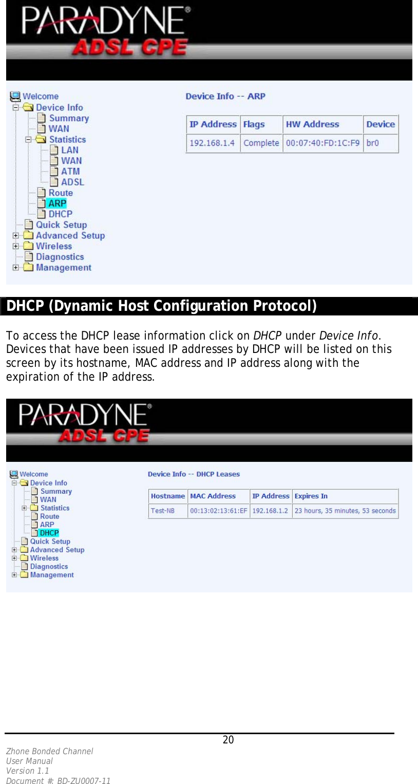   DHCP (Dynamic Host Configuration Protocol)  To access the DHCP lease information click on DHCP under Device Info. Devices that have been issued IP addresses by DHCP will be listed on this screen by its hostname, MAC address and IP address along with the expiration of the IP address.     20 Zhone Bonded Channel User Manual  Version 1.1 Document #: BD-ZU0007-11 