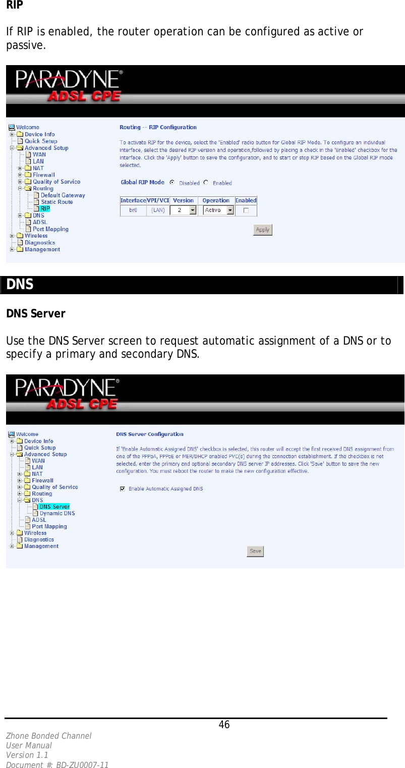 RIP   If RIP is enabled, the router operation can be configured as active or passive.     DNS   DNS Server   Use the DNS Server screen to request automatic assignment of a DNS or to specify a primary and secondary DNS.       46 Zhone Bonded Channel User Manual  Version 1.1 Document #: BD-ZU0007-11 