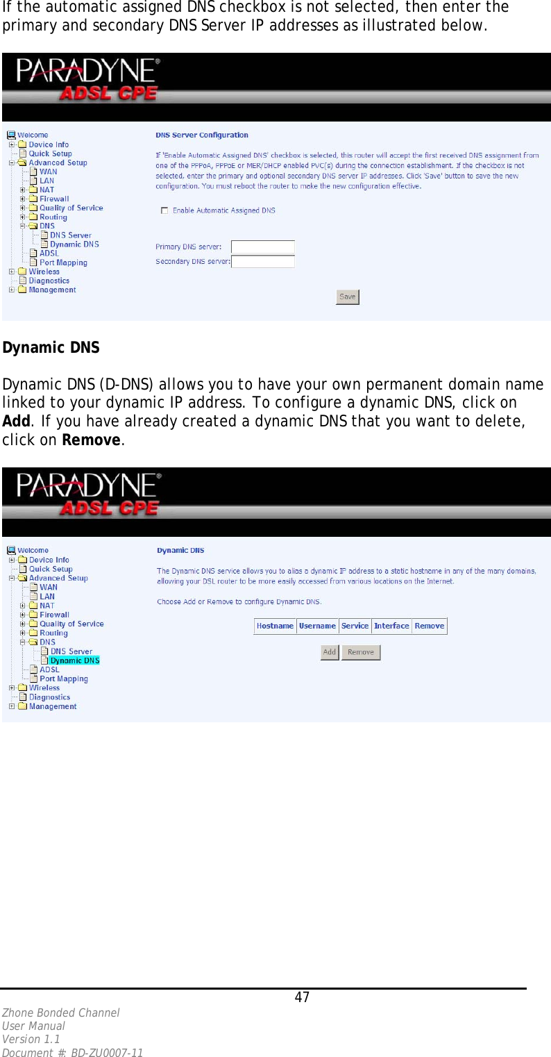 If the automatic assigned DNS checkbox is not selected, then enter the primary and secondary DNS Server IP addresses as illustrated below.    Dynamic DNS  Dynamic DNS (D-DNS) allows you to have your own permanent domain name linked to your dynamic IP address. To configure a dynamic DNS, click on Add. If you have already created a dynamic DNS that you want to delete, click on Remove.       47 Zhone Bonded Channel User Manual  Version 1.1 Document #: BD-ZU0007-11 