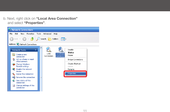 11b. Next, right click on &ldquo;Local Area Connection&rdquo; and select &ldquo;Properties&rdquo;.