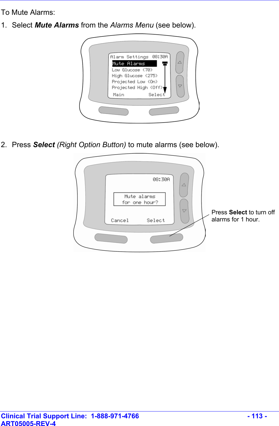    Clinical Trial Support Line:  1-888-971-4766   - 113 - ART05005-REV-4   To Mute Alarms: 1. Select Mute Alarms from the Alarms Menu (see below).    2. Press Select (Right Option Button) to mute alarms (see below).   Press Select to turn off alarms for 1 hour. 