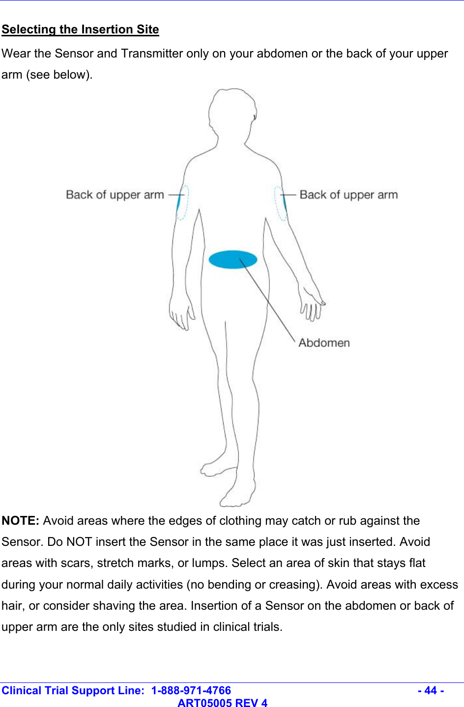   Clinical Trial Support Line:  1-888-971-4766   - 44 -   ART05005 REV 4 Selecting the Insertion Site Wear the Sensor and Transmitter only on your abdomen or the back of your upper arm (see below).   NOTE: Avoid areas where the edges of clothing may catch or rub against the Sensor. Do NOT insert the Sensor in the same place it was just inserted. Avoid areas with scars, stretch marks, or lumps. Select an area of skin that stays flat during your normal daily activities (no bending or creasing). Avoid areas with excess hair, or consider shaving the area. Insertion of a Sensor on the abdomen or back of upper arm are the only sites studied in clinical trials.   