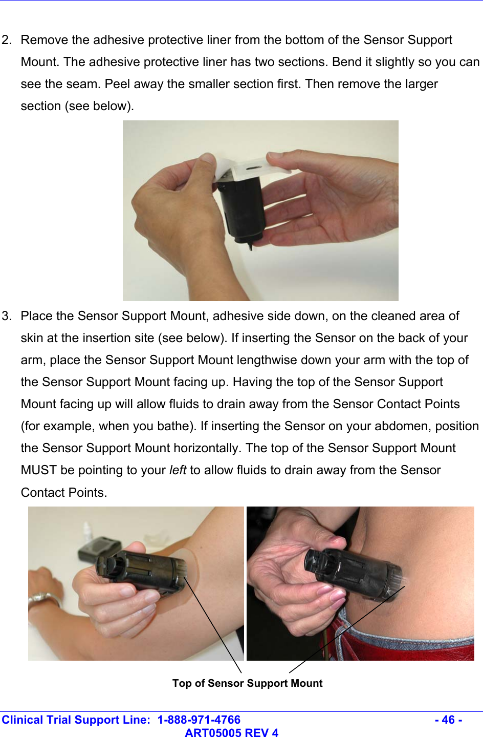   Clinical Trial Support Line:  1-888-971-4766   - 46 -   ART05005 REV 4  2.  Remove the adhesive protective liner from the bottom of the Sensor Support Mount. The adhesive protective liner has two sections. Bend it slightly so you can see the seam. Peel away the smaller section first. Then remove the larger section (see below).  3.  Place the Sensor Support Mount, adhesive side down, on the cleaned area of skin at the insertion site (see below). If inserting the Sensor on the back of your arm, place the Sensor Support Mount lengthwise down your arm with the top of the Sensor Support Mount facing up. Having the top of the Sensor Support Mount facing up will allow fluids to drain away from the Sensor Contact Points (for example, when you bathe). If inserting the Sensor on your abdomen, position the Sensor Support Mount horizontally. The top of the Sensor Support Mount MUST be pointing to your left to allow fluids to drain away from the Sensor Contact Points.     Top of Sensor Support Mount 