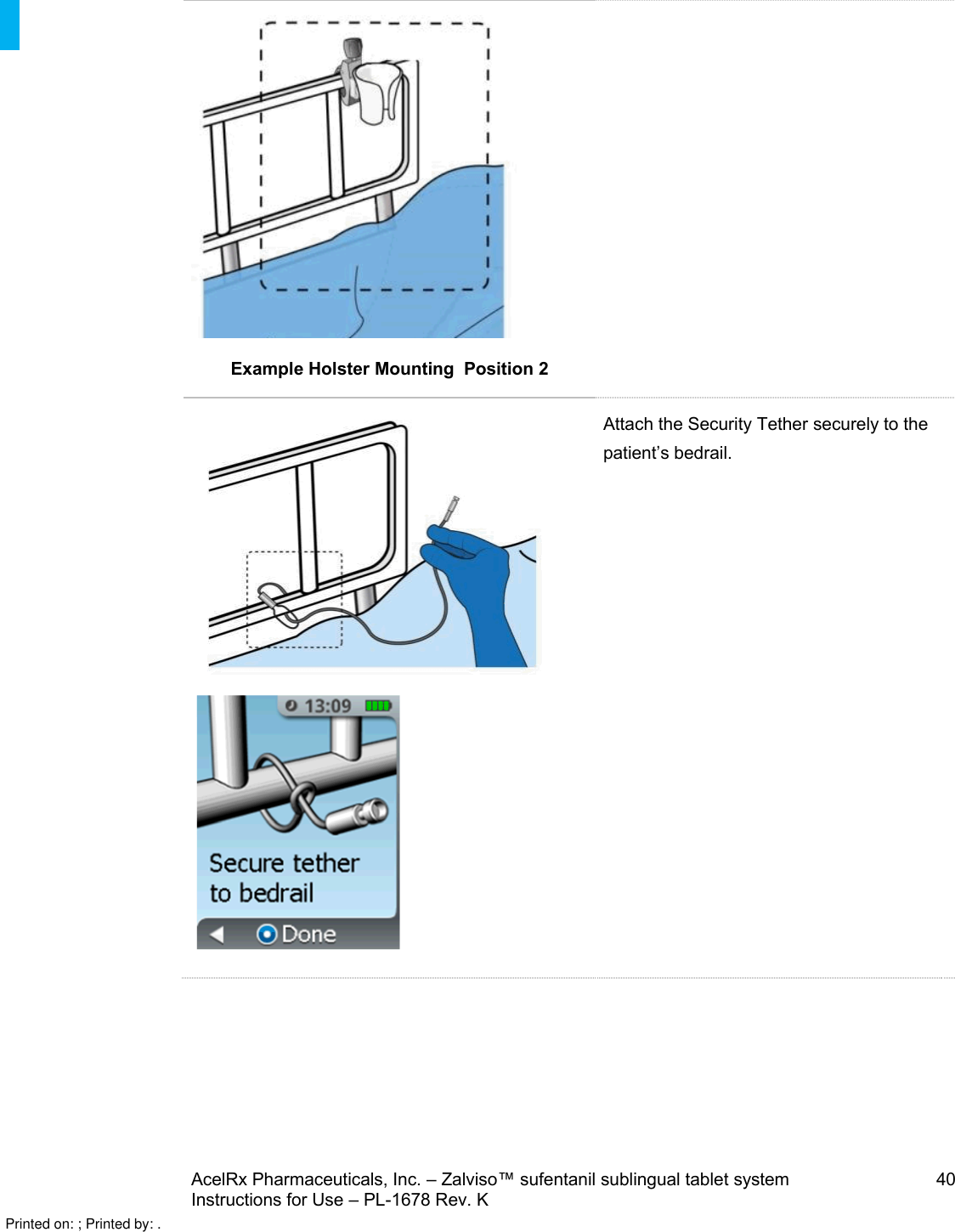 AcelRx Pharmaceuticals, Inc. –Zalviso™ sufentanil sublingual tablet system 40Instructions for Use –PL-1678 Rev. K Example Holster Mounting  Position 2Attach the Security Tether securely to the patient’s bedrail.Printed on: ; Printed by: .