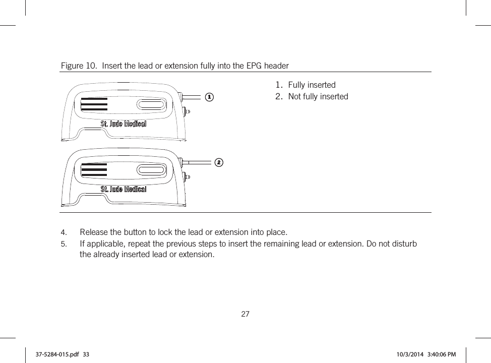  27   Figure 10.  Insert the lead or extension fully into the EPG header   1.  Fully inserted 2.  Not fully inserted  4. Release the button to lock the lead or extension into place. 5. If applicable, repeat the previous steps to insert the remaining lead or extension. Do not disturb the already inserted lead or extension.  37-5284-015.pdf   33 10/3/2014   3:40:06 PM