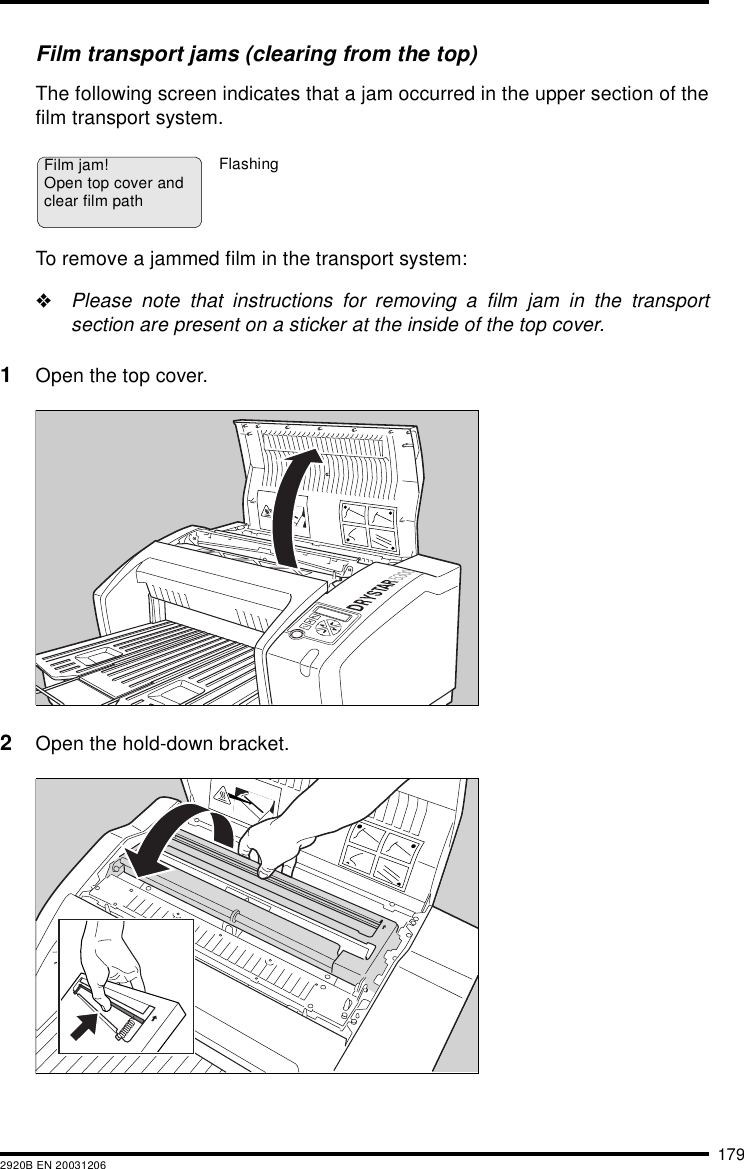 1792920B EN 20031206Film transport jams (clearing from the top)The following screen indicates that a jam occurred in the upper section of thefilm transport system.To remove a jammed film in the transport system:&quot;Please note that instructions for removing a film jam in the transportsection are present on a sticker at the inside of the top cover.1Open the top cover.2Open the hold-down bracket.Film jam!Open top cover andclear film pathFlashing