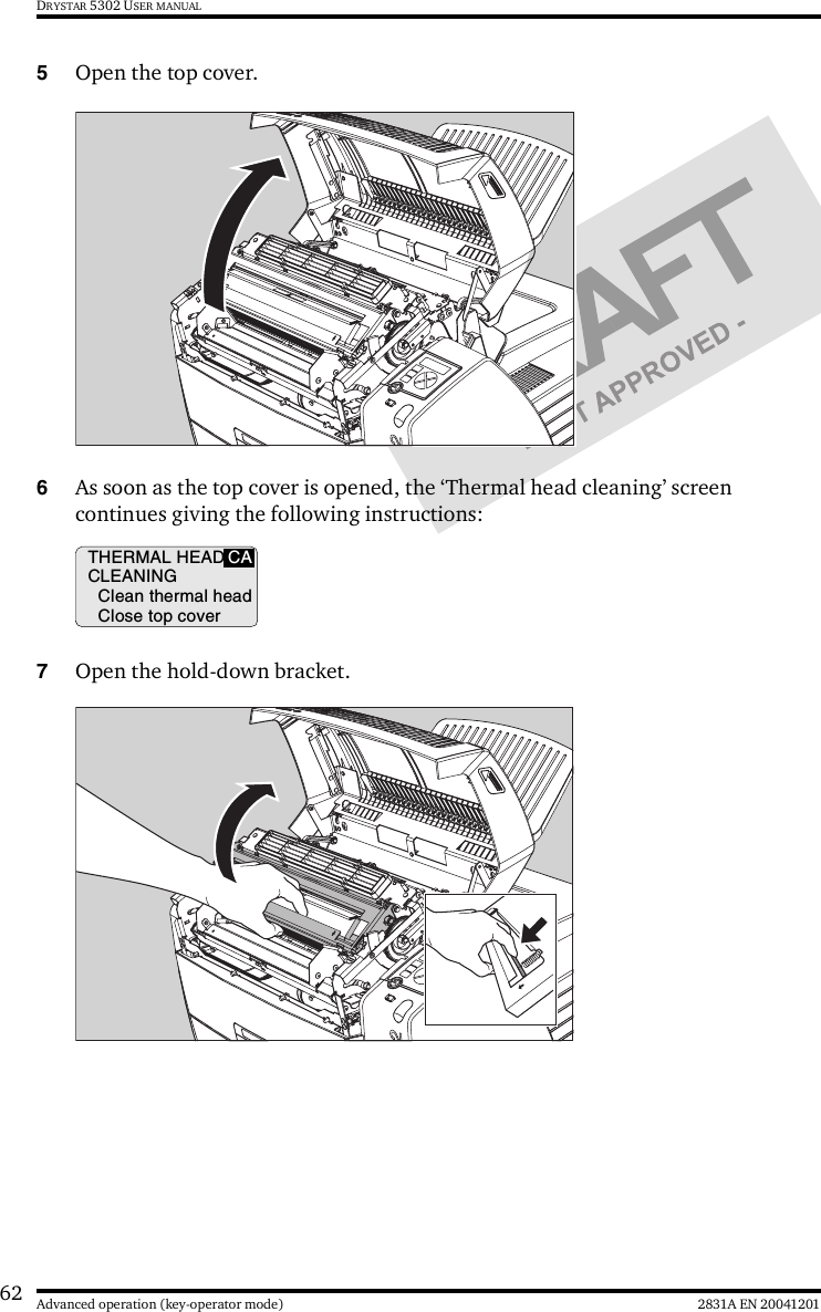 62 2831A EN 20041201Advanced operation (key-operator mode)DRYSTAR 5302 USER MANUAL5Open the top cover.6As soon as the top cover is opened, the ‘Thermal head cleaning’ screen continues giving the following instructions:7Open the hold-down bracket.THERMAL HEADCLEANINGClean thermal headClose top coverCA