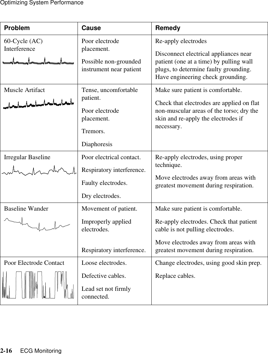 Optimizing System Performance2-16     ECG MonitoringProblem Cause Remedy60-Cycle (AC) Interference Poor electrode placement.Possible non-grounded instrument near patientRe-apply electrodesDisconnect electrical appliances near patient (one at a time) by pulling wall plugs, to determine faulty grounding. Have engineering check grounding.Muscle Artifact Tense, uncomfortable patient.Poor electrode placement.Tremors.DiaphoresisMake sure patient is comfortable.Check that electrodes are applied on flat non-muscular areas of the torso; dry the skin and re-apply the electrodes if necessary.Irregular Baseline Poor electrical contact.Respiratory interference.Faulty electrodes.Dry electrodes.Re-apply electrodes, using proper technique.Move electrodes away from areas with greatest movement during respiration.Baseline Wander Movement of patient.Improperly applied electrodes.Respiratory interference.Make sure patient is comfortable.Re-apply electrodes. Check that patient cable is not pulling electrodes.Move electrodes away from areas with greatest movement during respiration.Poor Electrode Contact Loose electrodes.Defective cables.Lead set not firmly connected.Change electrodes, using good skin prep.Replace cables.