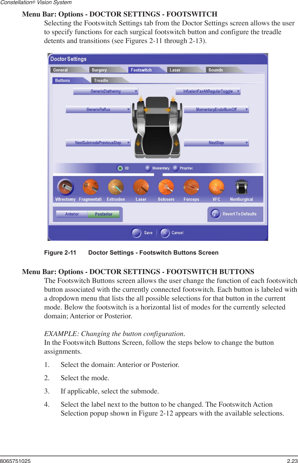 8065751025  2.23Constellation® Vision System Menu Bar: Options - DOCTOR SETTINGS - FOOTSWITCHSelecting the Footswitch Settings tab from the Doctor Settings screen allows the user to specify functions for each surgical footswitch button and configure the treadle detents and transitions (see Figures 2-11 through 2-13). Figure 2-11  Doctor Settings - Footswitch Buttons ScreenMenu Bar: Options - DOCTOR SETTINGS - FOOTSWITCH BUTTONSThe Footswitch Buttons screen allows the user change the function of each footswitch button associated with the currently connected footswitch. Each button is labeled with a dropdown menu that lists the all possible selections for that button in the current mode. Below the footswitch is a horizontal list of modes for the currently selected domain; Anterior or Posterior.EXAMPLE: Changing the button configuration.In the Footswitch Buttons Screen, follow the steps below to change the button assignments.1.   Select the domain: Anterior or Posterior.2.   Select the mode.3.   If applicable, select the submode.4.   Select the label next to the button to be changed. The Footswitch Action Selection popup shown in Figure 2-12 appears with the available selections.