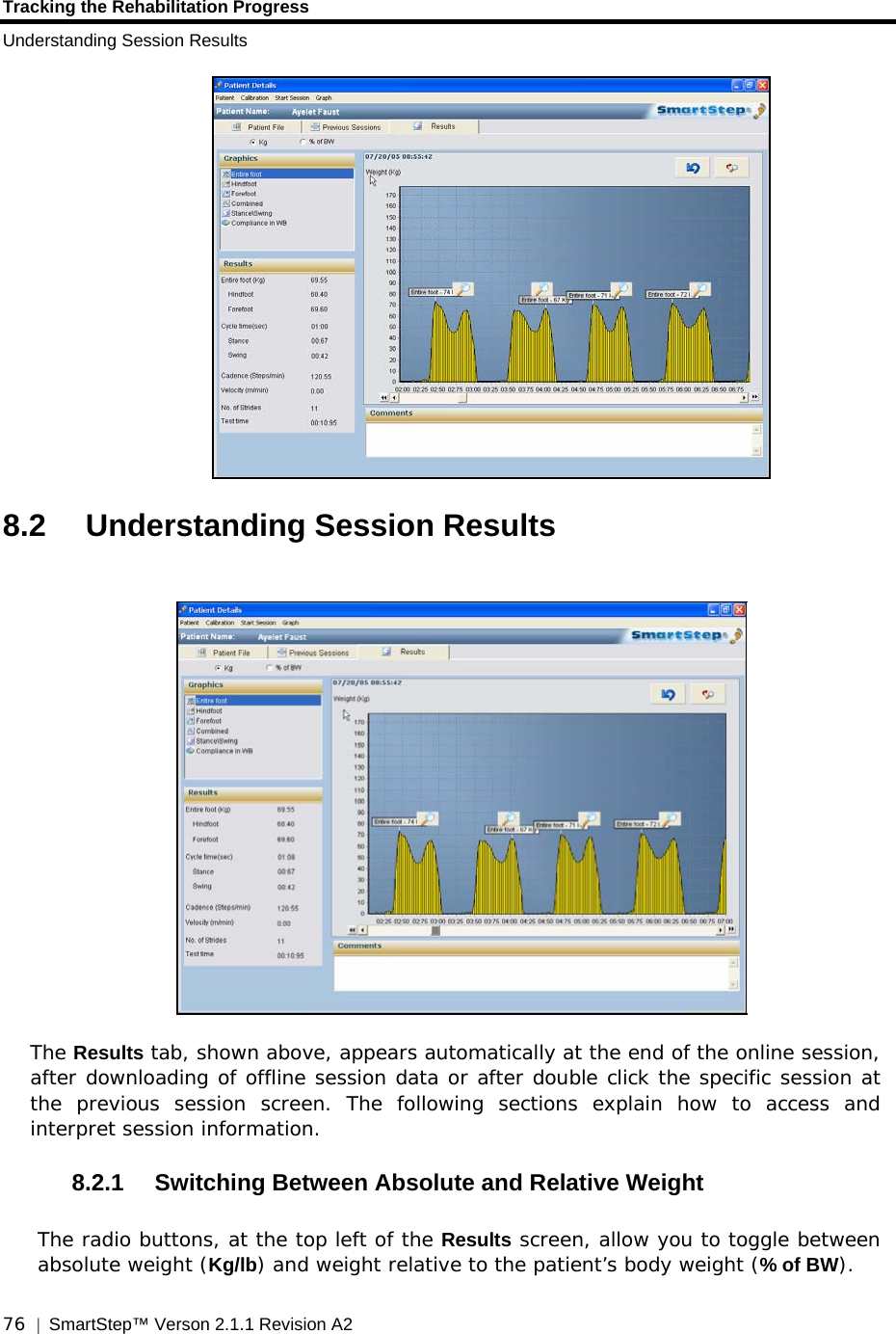 Tracking the Rehabilitation Progress Understanding Session Results  76  |  SmartStep™ Verson 2.1.1 Revision A2    8.2 Understanding Session Results   The Results tab, shown above, appears automatically at the end of the online session, after downloading of offline session data or after double click the specific session at the previous session screen. The following sections explain how to access and interpret session information. 8.2.1  Switching Between Absolute and Relative Weight The radio buttons, at the top left of the Results screen, allow you to toggle between absolute weight (Kg/lb) and weight relative to the patient’s body weight (% of BW).   