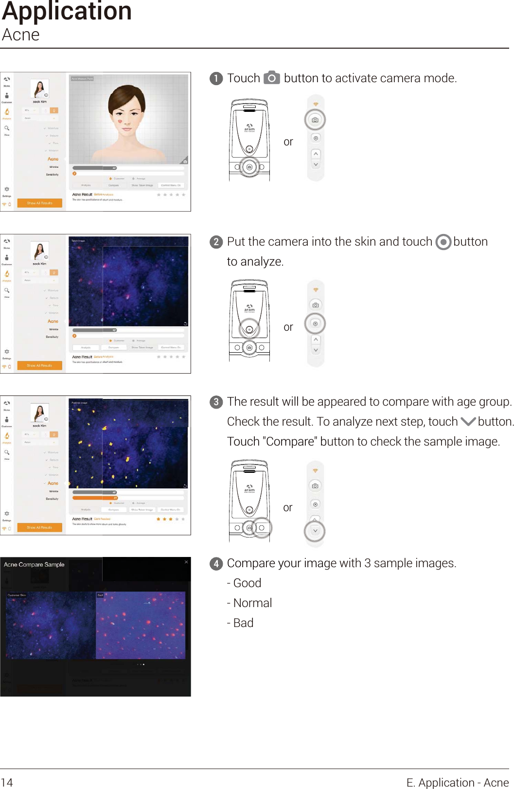 The result will be appeared to compare with age group.Check the result. To analyze next step, touch       button.Touch &quot;Compare&quot; button to check the sample image.3ApplicationAcnePut the camera into the skin and touch       button to analyze.2Compare your image with 3 sample images.- Good- Normal- Bad4Touch        button to activate camera mode.1orTouch        button to     1ororTheresultwillbeap3to analyze.ororTouch &quot;Compare&quot; bCompare your imagGood4or14 E. Application - Acne