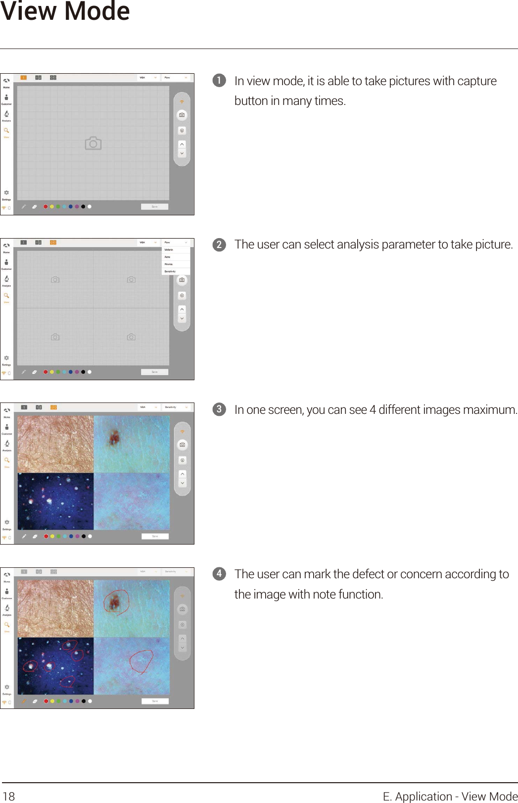 1View ModeIn view mode, it is able to take pictures with capture button in many times.2The user can select analysis parameter to take picture. 3In one screen, you can see 4 different images maximum.   4The user can mark the defect or concern according to the image with note function.18 E. Application - View Mode