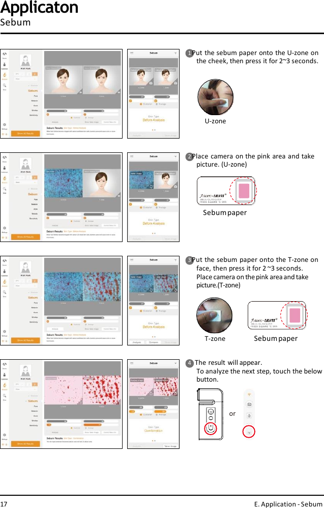U-zoneSebumpaperor1Put the sebum paper onto the U-zone on  the cheek, then press it for 2~3 seconds.2Place camera on the pink area and take  picture. (U-zone)3 Put the sebum paper onto the T-zone on  face, then press it for 2 ~3 seconds.Place camera on the pink areaand take  picture.(T-zone)T-zone Sebumpaper4    The result will appear.To analyze the next step, touch the below  button.17 E. Application - SebumApplicatonSebum