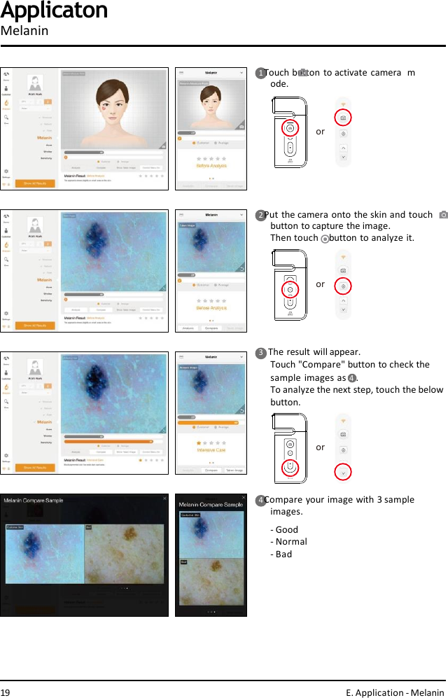 ororor1 Touch button to activate camera  mode.2 Put the camera onto the skin and touch  button to capture the image.Then touch    button to analyze it.4 Compare your image with 3 sample  images.-Good- Normal- BadApplicatonMelanin3    The result will appear.Touch &quot;Compare&quot; button to check the  sample images as 4  .To analyze the next step, touch the belowbutton.19 E. Application - Melanin