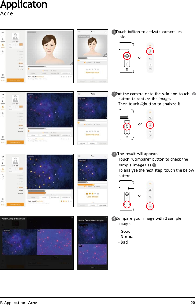 ororor1 Touch button to activate camera  mode.2 Put the camera onto the skin and touch  button to capture the image.Then touch    button to analyze it.4 Compare your image with 3 sample  images.-Good- Normal- BadApplicatonAcne3    The result will appear.Touch &quot;Compare&quot; button to check the  sample images as 4  .To analyze the next step, touch the belowbutton.E. Application - Acne 20