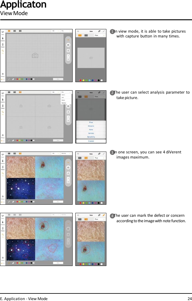 1In view mode, it is able to take pictures  with capture button in many times.2 The user can select analysis parameter to  takepicture.3 In one screen, you can see 4 diVerent  images maximum.4 The user can mark the defect or concern  accordingto the image with note function.E. Application - View Mode 24ApplicatonViewMode