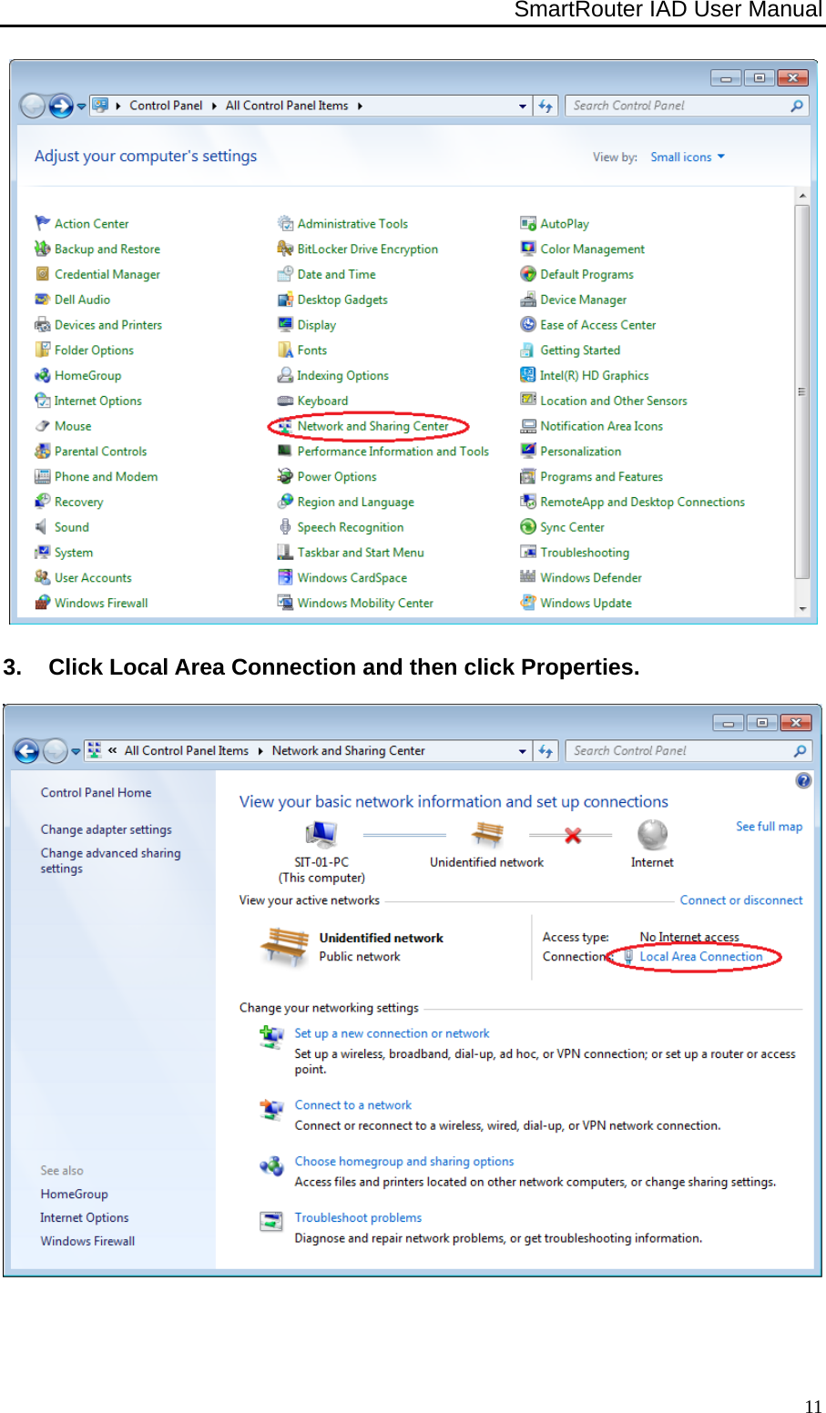 SmartRouter IAD User Manual              11 3.  Click Local Area Connection and then click Properties.   