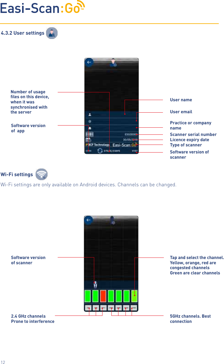 TM12User nameUser emailLicence expiry dateType of scannerSoftware version of   scannerTap and select the channel. Yellow, orange, red are congested channels Green are clear channels5GHz channels. Best connectionSoftware version of  app        Software version of scanner        2.4 GHz channels Prone to interferenceNumber of usage les on this device, w h e n  i t  w a s                                                        synchronised with the serverScanner serial numberPractice or company name4.3.2 User settingsWi-Fi settingsWi-Fi settings are only available on Android devices. Channels can be changed.
