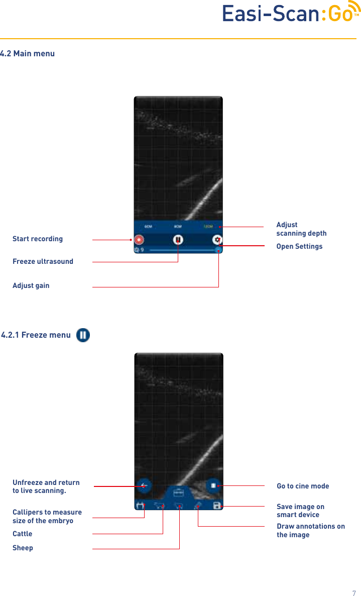 TM7Unfreeze and return to live scanning.Callipers to measure size of the embryo Draw annotations on the image4.2.1 Freeze menuCattleSheepGo to cine modeSave image on smart deviceStart recordingFreeze ultrasoundOpen SettingsAdjust gain4.2 Main menuAdjust  scanning depth