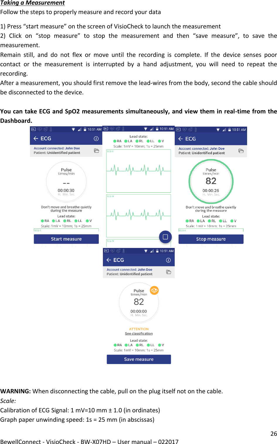 26 BewellConnect - VisioCheck - BW-X07HD – User manual – 022017   Taking a Measurement  Follow the steps to properly measure and record your data 1) Press “start measure” on the screen of VisioCheck to launch the measurement  2)  Click  on  “stop  measure”  to  stop  the  measurement  and  then  “save  measure”,  to  save  the measurement. Remain  still,  and  do  not  flex  or  move  until  the  recording  is  complete.  If  the  device  senses  poor contact  or  the  measurement  is  interrupted  by  a  hand  adjustment,  you  will  need  to  repeat  the recording. After a measurement, you should first remove the lead-wires from the body, second the cable should be disconnected to the device.  You can take ECG and SpO2 measurements simultaneously, and view them in real-time from the Dashboard.     WARNING: When disconnecting the cable, pull on the plug itself not on the cable. Scale:  Calibration of ECG Signal: 1 mV=10 mm ± 1.0 (in ordinates) Graph paper unwinding speed: 1s = 25 mm (in abscissas) 