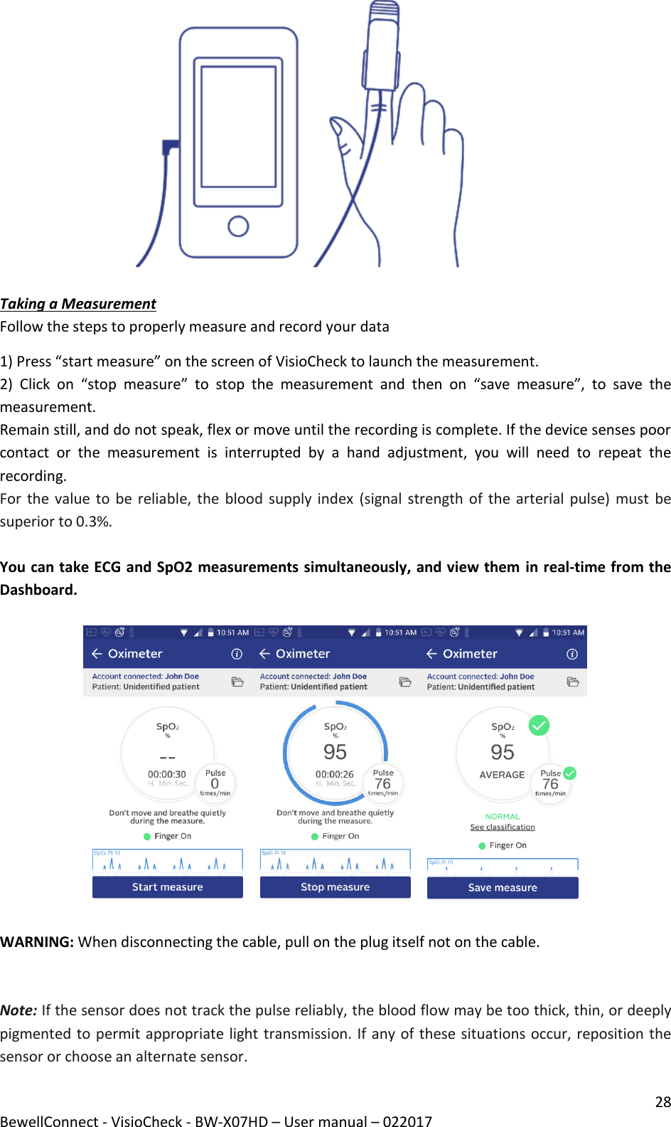 28 BewellConnect - VisioCheck - BW-X07HD – User manual – 022017                                         Taking a Measurement  Follow the steps to properly measure and record your data 1) Press “start measure” on the screen of VisioCheck to launch the measurement. 2)  Click  on  “stop  measure”  to  stop  the  measurement  and  then  on  “save  measure”,  to  save  the measurement. Remain still, and do not speak, flex or move until the recording is complete. If the device senses poor contact  or  the  measurement  is  interrupted  by  a  hand  adjustment,  you  will  need  to  repeat  the recording. For the value to be reliable,  the  blood  supply index (signal strength of the arterial pulse) must  be superior to 0.3%.  You can take ECG and SpO2 measurements simultaneously, and view them in real-time from the Dashboard.    WARNING: When disconnecting the cable, pull on the plug itself not on the cable.   Note: If the sensor does not track the pulse reliably, the blood flow may be too thick, thin, or deeply pigmented to permit appropriate light transmission. If any of these situations occur, reposition the sensor or choose an alternate sensor. 