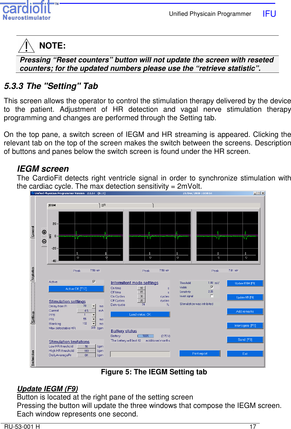    Unified Physicain Programmer   IFU     RU-53-001 H                                                                                                                            17    NOTE: Pressing “Reset counters” button will not update the screen with reseted counters; for the updated numbers please use the “retrieve statistic”.  5.3.3 The &quot;Setting&quot; Tab  This screen allows the operator to control the stimulation therapy delivered by the device to  the  patient.  Adjustment  of  HR  detection  and  vagal  nerve  stimulation  therapy programming and changes are performed through the Setting tab.  On the top pane, a switch screen of IEGM and HR streaming is appeared. Clicking the relevant tab on the top of the screen makes the switch between the screens. Description of buttons and panes below the switch screen is found under the HR screen.  IEGM screen The CardioFit detects right ventricle signal in order to synchronize stimulation with the cardiac cycle. The max detection sensitivity = 2mVolt.  Figure 5: The IEGM Setting tab  Update IEGM (F9) Button is located at the right pane of the setting screen Pressing the button will update the three windows that compose the IEGM screen. Each window represents one second. 