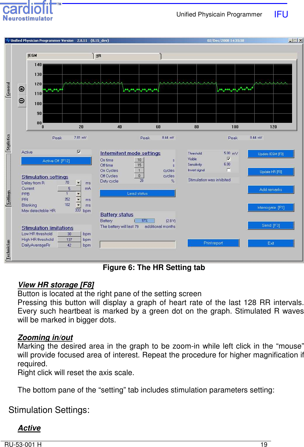    Unified Physicain Programmer   IFU     RU-53-001 H                                                                                                                            19   Figure 6: The HR Setting tab  View HR storage [F8] Button is located at the right pane of the setting screen Pressing this button will display a graph of heart rate of the last 128 RR intervals. Every such heartbeat is marked by a green dot on the graph. Stimulated R waves will be marked in bigger dots.   Zooming in/out Marking the desired area in the graph to be zoom-in while left click in the “mouse” will provide focused area of interest. Repeat the procedure for higher magnification if required. Right click will reset the axis scale.  The bottom pane of the “setting” tab includes stimulation parameters setting:  Stimulation Settings:  Active 