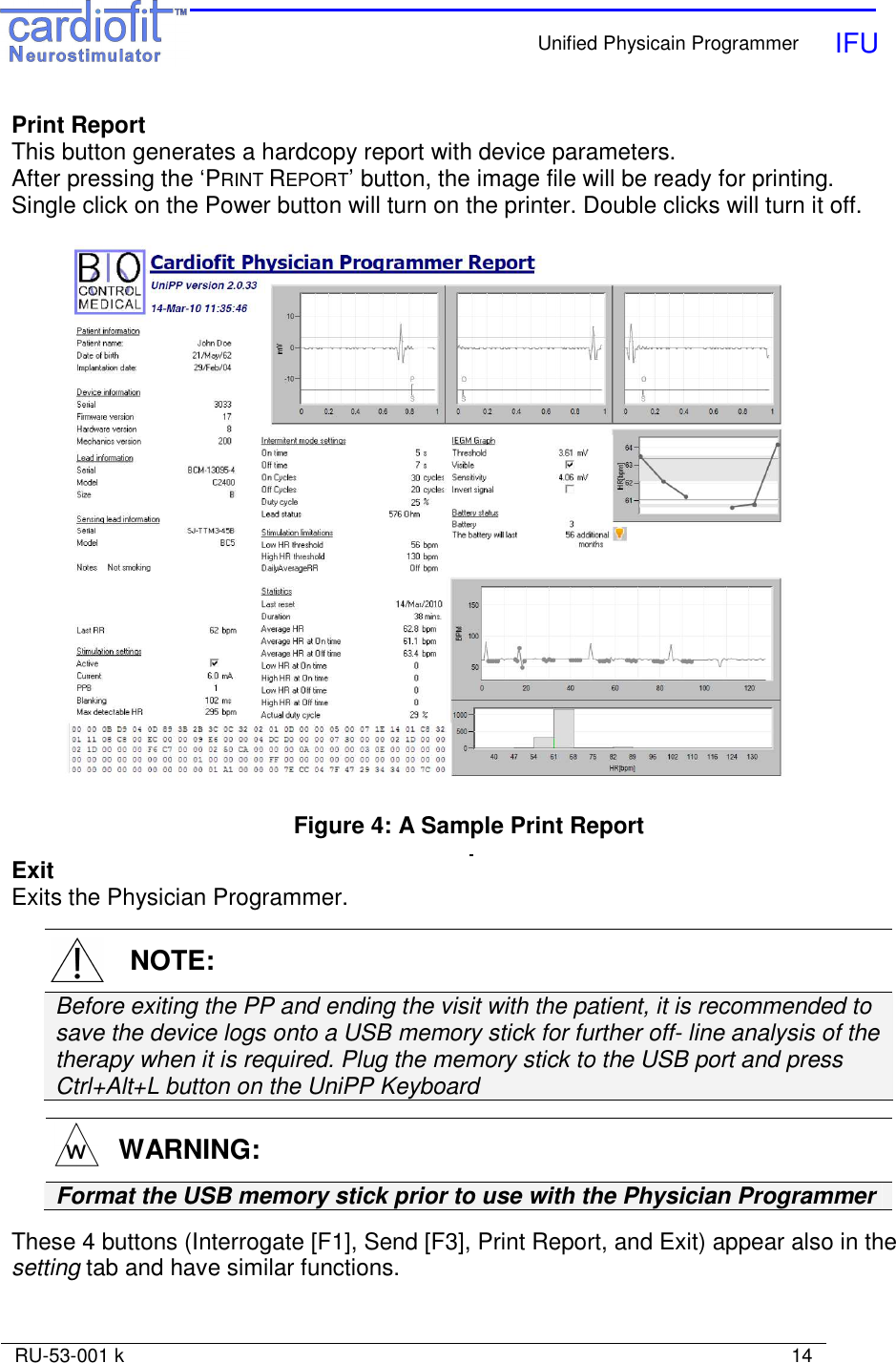    Unified Physicain Programmer   IFU     RU-53-001 k                                                                                                                            14  Print Report  This button generates a hardcopy report with device parameters. After pressing the ‘PRINT REPORT’ button, the image file will be ready for printing. Single click on the Power button will turn on the printer. Double clicks will turn it off.   Figure 4: A Sample Print Report    Exit Exits the Physician Programmer.    NOTE: Before exiting the PP and ending the visit with the patient, it is recommended to save the device logs onto a USB memory stick for further off- line analysis of the therapy when it is required. Plug the memory stick to the USB port and press Ctrl+Alt+L button on the UniPP Keyboard     WARNING: Format the USB memory stick prior to use with the Physician Programmer  These 4 buttons (Interrogate [F1], Send [F3], Print Report, and Exit) appear also in the setting tab and have similar functions. 