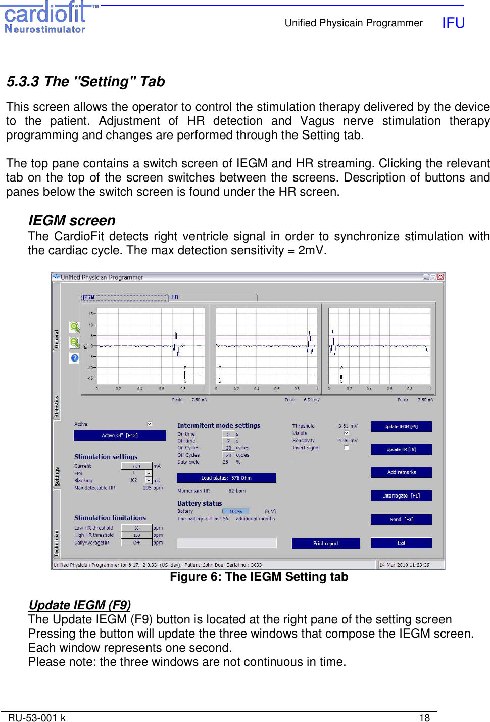    Unified Physicain Programmer   IFU     RU-53-001 k                                                                                                                            18   5.3.3 The &quot;Setting&quot; Tab  This screen allows the operator to control the stimulation therapy delivered by the device to  the  patient.  Adjustment  of  HR  detection  and  Vagus  nerve  stimulation  therapy programming and changes are performed through the Setting tab.  The top pane contains a switch screen of IEGM and HR streaming. Clicking the relevant tab on the top of the screen switches between the screens. Description of buttons and panes below the switch screen is found under the HR screen.  IEGM screen The CardioFit detects right ventricle signal in order to synchronize stimulation with the cardiac cycle. The max detection sensitivity = 2mV.   Figure 6: The IEGM Setting tab  Update IEGM (F9) The Update IEGM (F9) button is located at the right pane of the setting screen Pressing the button will update the three windows that compose the IEGM screen. Each window represents one second. Please note: the three windows are not continuous in time. 