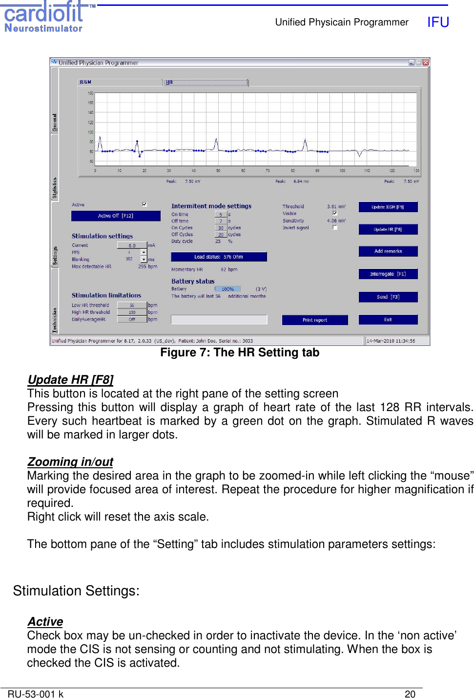    Unified Physicain Programmer   IFU     RU-53-001 k                                                                                                                            20   Figure 7: The HR Setting tab  Update HR [F8] This button is located at the right pane of the setting screen Pressing this button will display a graph of heart rate of the last 128 RR intervals. Every such heartbeat is marked by a green dot on the graph. Stimulated R waves will be marked in larger dots.   Zooming in/out Marking the desired area in the graph to be zoomed-in while left clicking the “mouse” will provide focused area of interest. Repeat the procedure for higher magnification if required. Right click will reset the axis scale.  The bottom pane of the “Setting” tab includes stimulation parameters settings:   Stimulation Settings:  Active Check box may be un-checked in order to inactivate the device. In the ‘non active’ mode the CIS is not sensing or counting and not stimulating. When the box is checked the CIS is activated. 