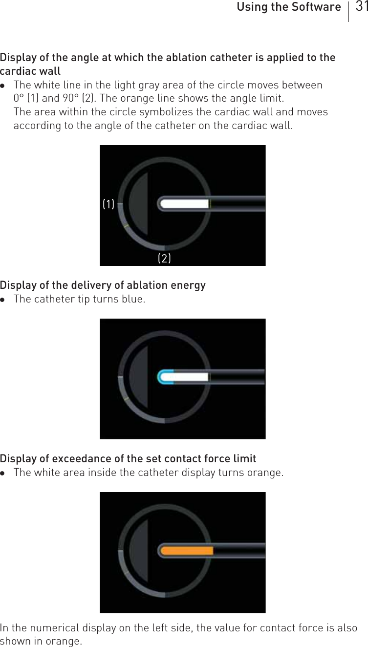 Using the Software 31Display of the angle at which the ablation catheter is applied to the cardiac wallzThe white line in the light gray area of the circle moves between 0° (1) and 90° (2). The orange line shows the angle limit.The area within the circle symbolizes the cardiac wall and moves according to the angle of the catheter on the cardiac wall.Display of the delivery of ablation energyzThe catheter tip turns blue.Display of exceedance of the set contact force limitzThe white area inside the catheter display turns orange.In the numerical display on the left side, the value for contact force is also shown in orange.