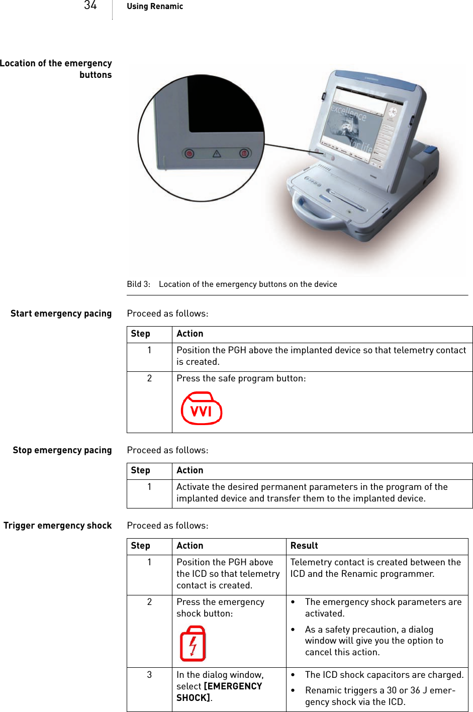 34 Using RenamicLocation of the emergencybuttonsBild 3: Location of the emergency buttons on the deviceStart emergency pacing Proceed as follows: Stop emergency pacing Proceed as follows: Trigger emergency shock Proceed as follows: Step Action1 Position the PGH above the implanted device so that telemetry contact is created.2 Press the safe program button:Step Action1 Activate the desired permanent parameters in the program of the implanted device and transfer them to the implanted device.Step Action Result1 Position the PGH above the ICD so that telemetry contact is created.Telemetry contact is created between the ICD and the Renamic programmer. 2 Press the emergency shock button:• The emergency shock parameters are activated.• As a safety precaution, a dialog window will give you the option to cancel this action.3 In the dialog window, select [EMERGENCY SHOCK].• The ICD shock capacitors are charged.• Renamic triggers a 30 or 36 J emer-gency shock via the ICD.