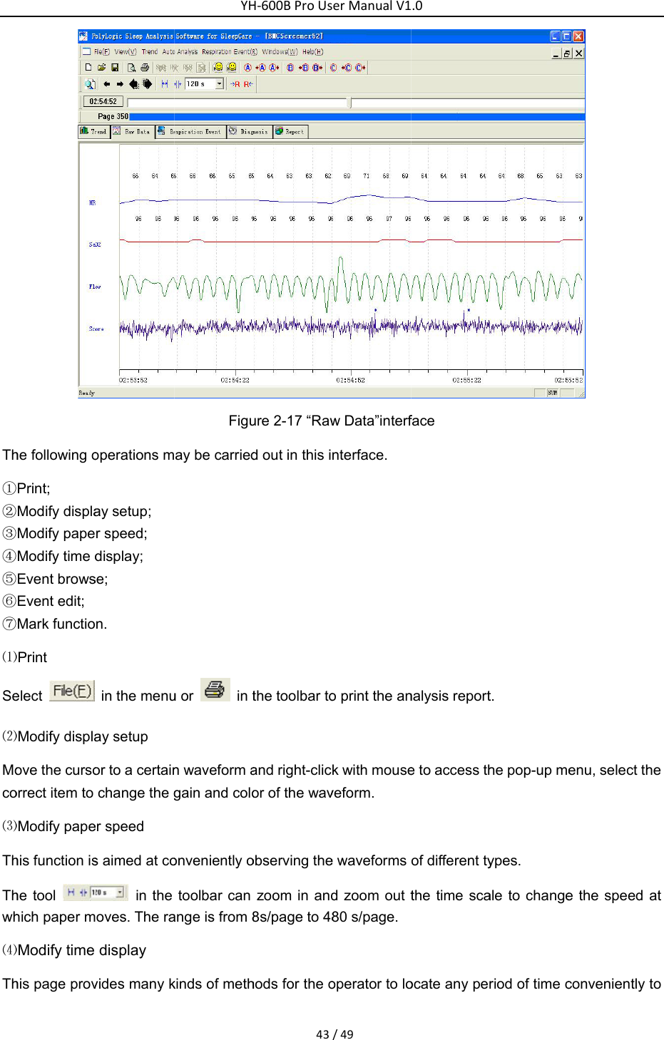 Th①②③④⑤⑥⑦⑴Se⑵Moco⑶ThThwh⑷Thhe following oPrint; Modify displaModify papeModify time dEvent browsEvent edit; Mark functio⑴Print elect  ⑵Modify displaove the cursoorrect item to ⑶Modify papehis function ishe tool hich paper m⑷Modify time his page provoperations may setup; r speed; display; se; n. in the menuay setup or to a certainchange the ger speed s aimed at co in the oves. The radisplay vides many kYHFiguay be carriedu or    in tn waveform again and coloonveniently otoolbar can ange is from 8kinds of methH‐600BProUs43ure 2-17 &ldquo;Rawd out in this ithe toolbar toand right-clicor of the wavobserving thezoom in and8s/page to 48hods for the oerManualV1/49w Data&rdquo;interfnterface. o print the ank with mouseveform. e waveforms d zoom out t80 s/page.operator to lo.0face nalysis reporte to access thof different tythe time scaocate any pert. he pop-up meypes. ale to changeriod of time c enu, select the the speed conveniently he at to 